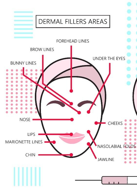 dermal filler areas